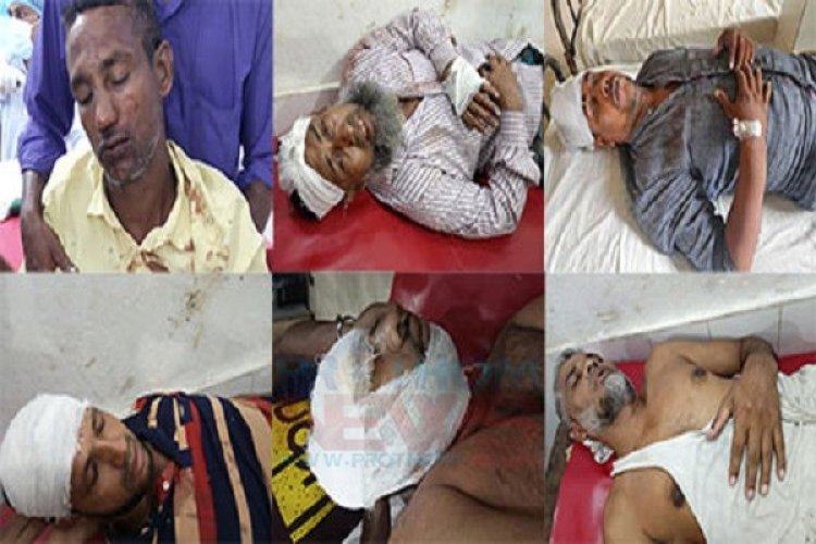 শরণখোলায় নির্বাচন পরবর্তী সহিংসতায় আহত ৪০