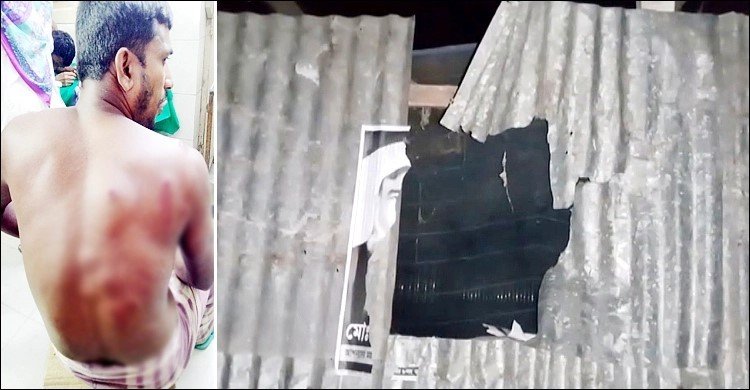 পাবনায় ভাড়াটে সন্ত্রাসী’ দিয়ে প্রেমিকের বাড়িতে হামলা, গুলিবিদ্ধ ৩