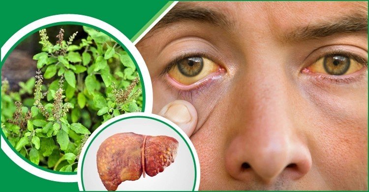 যে পাতায় দূর হবে জন্ডিস, লিভারও থাকবে ভালো