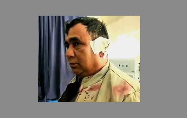 ঠাকুরগাঁওয়ে সাংবাদিককে কুপিয়ে জখম