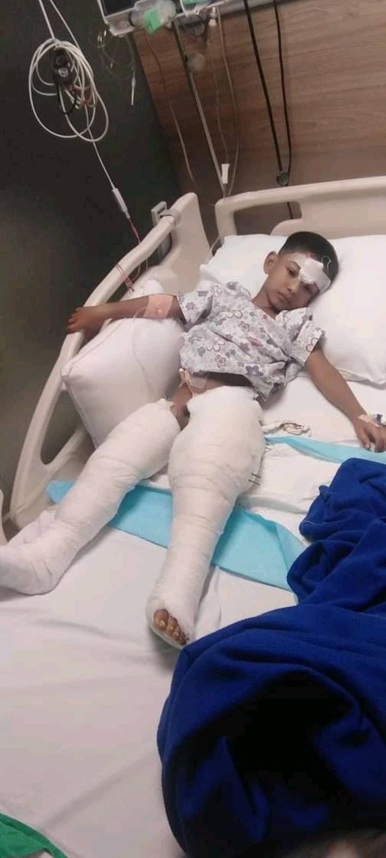 পা হারানো শিশু অগ্ররাজ হাসপাতালে আজীবন পুনর্বাসনের দাবিতে মানববন্ধন
