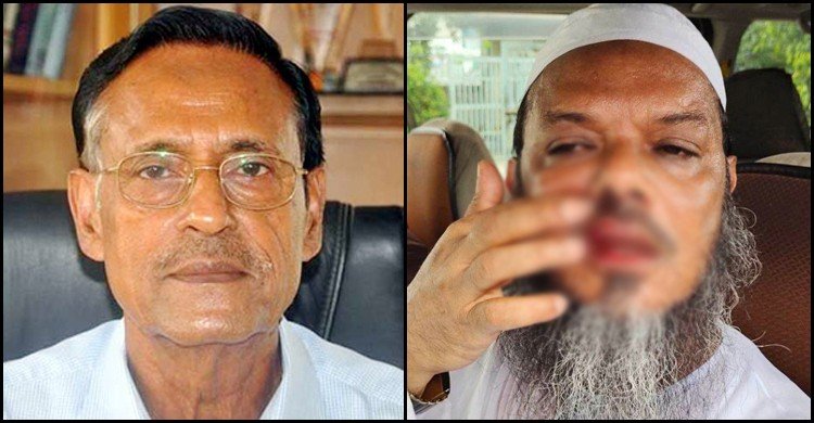 ফয়জুল করীমের ওপর হামলার ঘটনায় অলি আহমদের নিন্দা